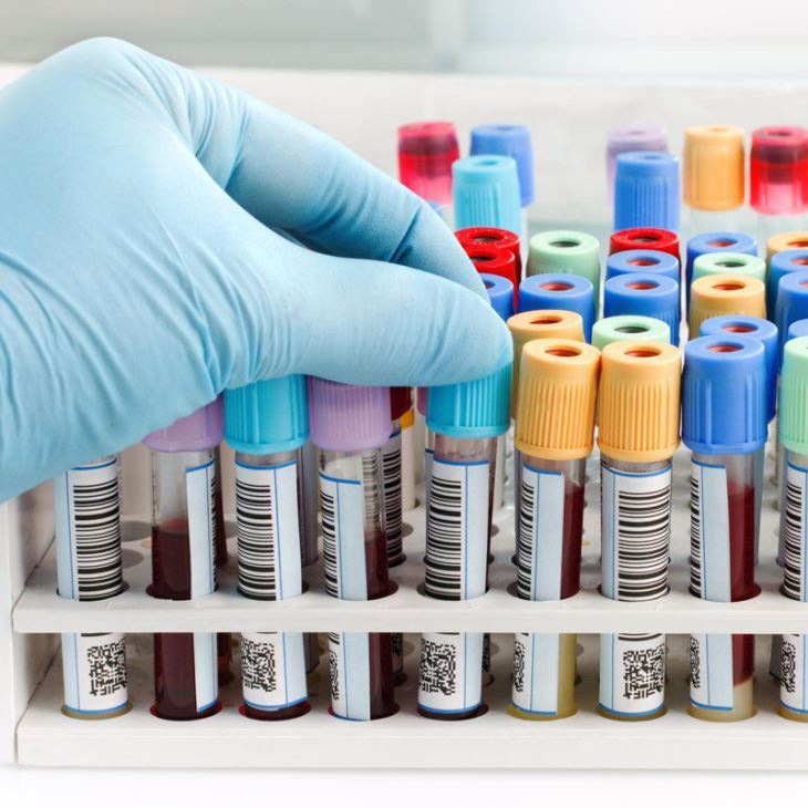 الصين يمكن التخلص منها اختبار Vacutainer تشخيص نظام جمع الدم أنبوب